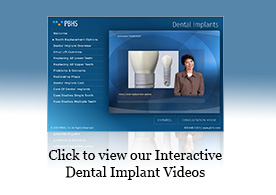 implant_retained_upper